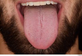 Orest tongue 0001.jpg